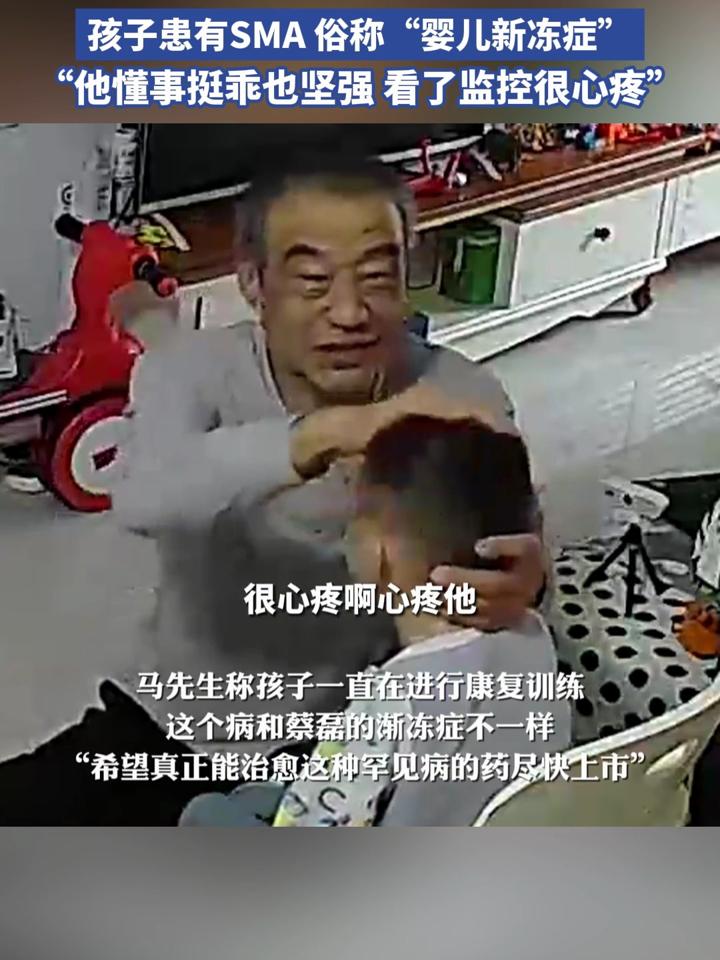 罕见病孩子摔倒