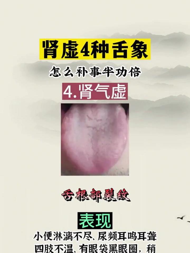 女性肾气虚图片