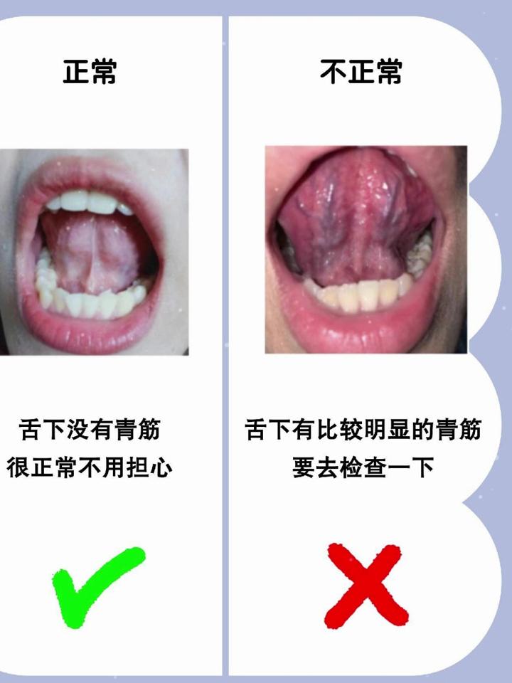 舌下构造图图片