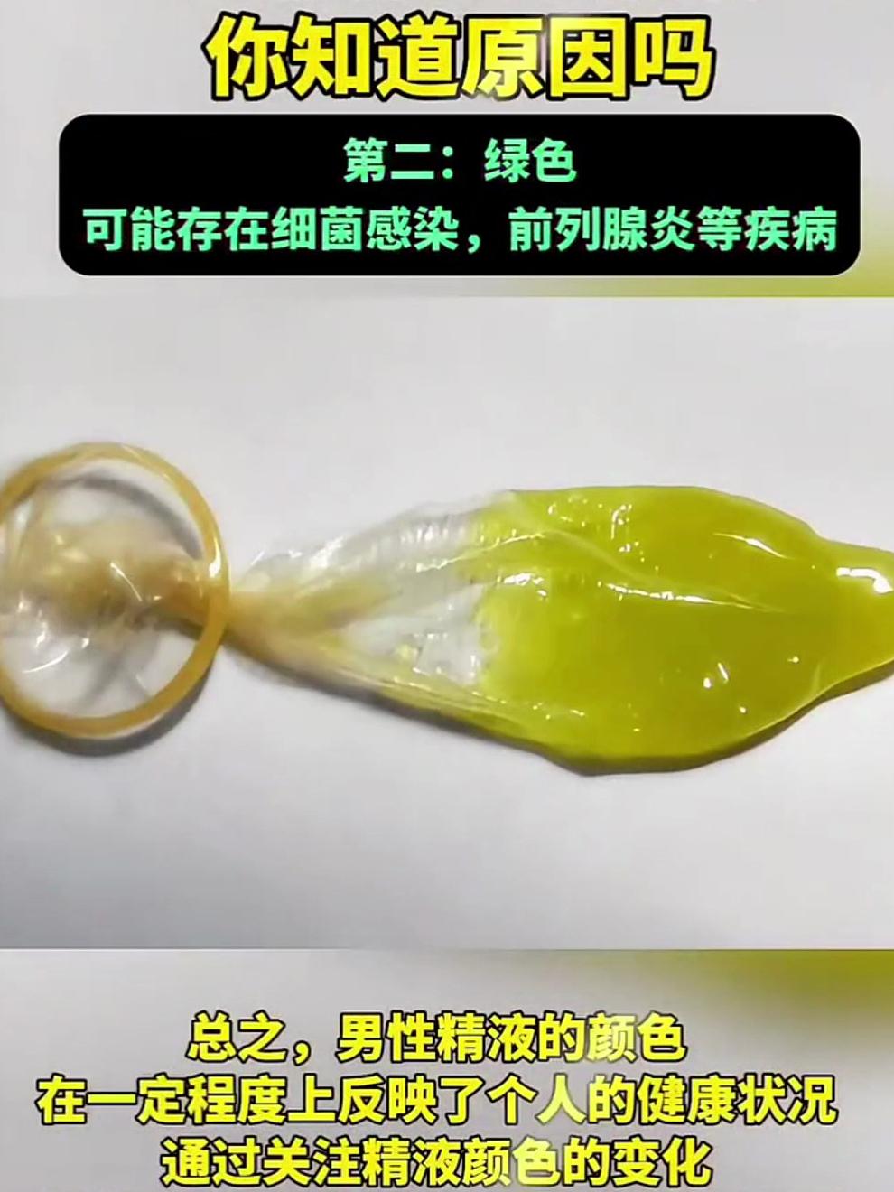 精子是什么颜色的正常图片