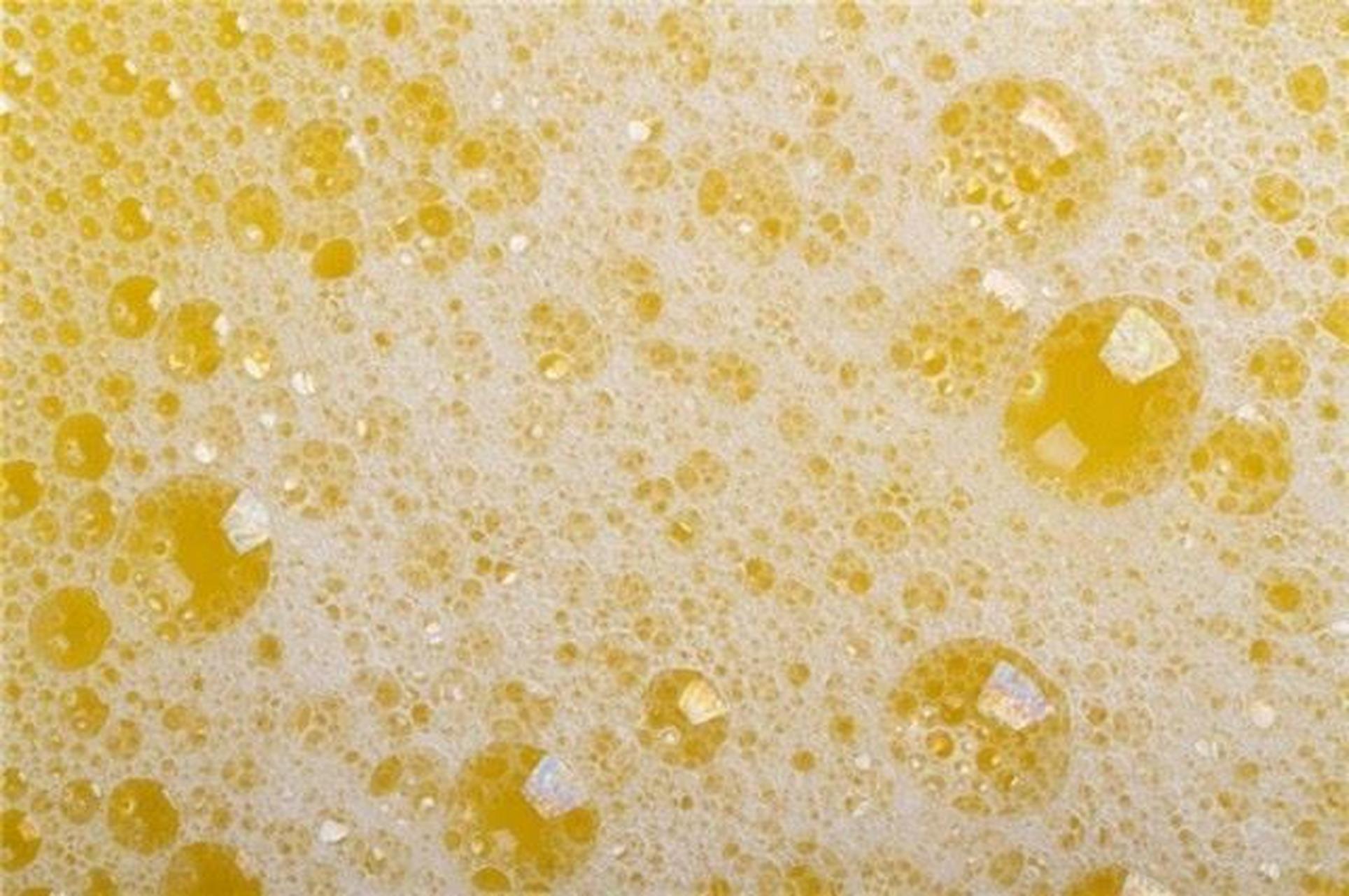 1,体内缺水:尿液当中有泡沫可能是身体缺乏水分引起,需要多喝白开水来