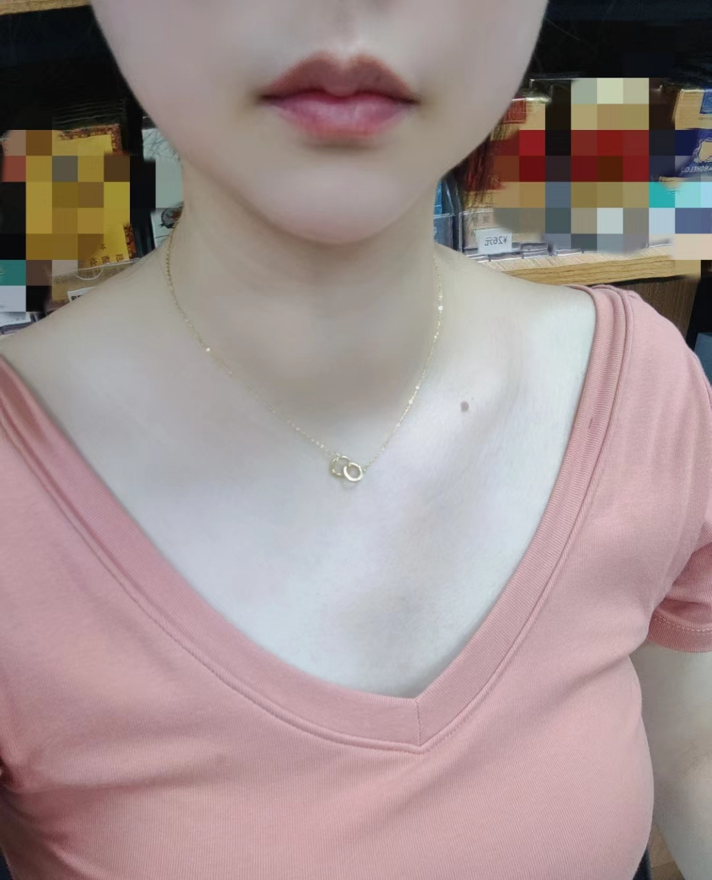 甲亢好了 粗脖子,心慌,不见了