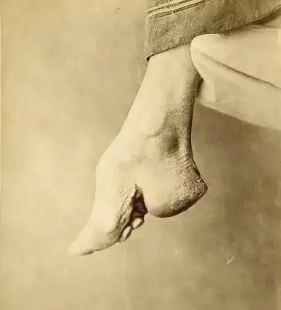 1870年,一个美国人费尽周折才让一位小脚妇人答应配合他拍张小脚的