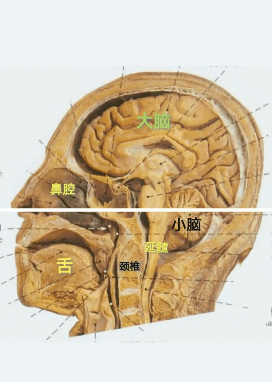 专业名称叫"矢状位",充分暴露了舌,鼻腔,大脑,小脑,延髓,颈椎等解剖