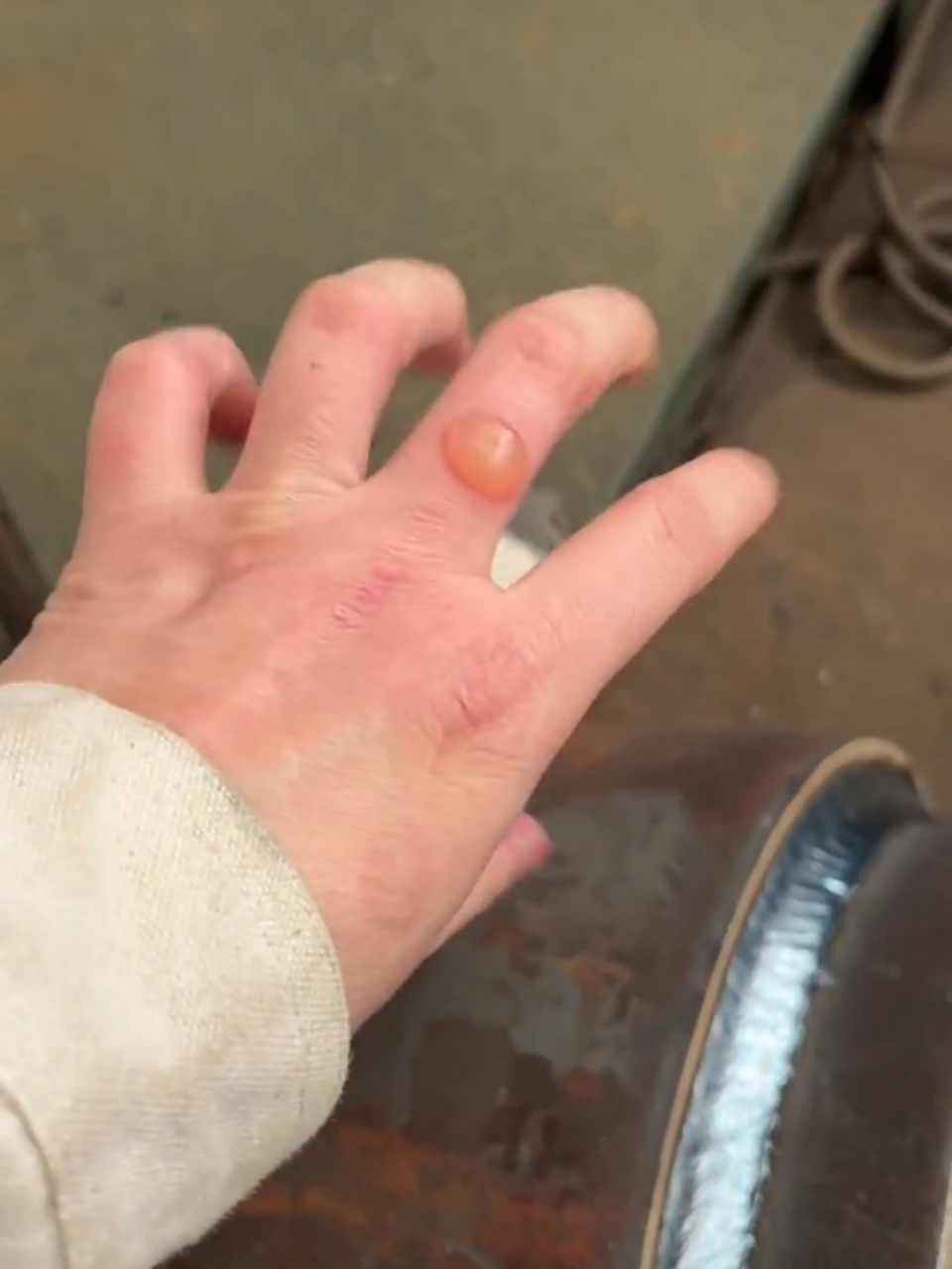 一天才赚500块,手指还被烫伤,生活太难了.