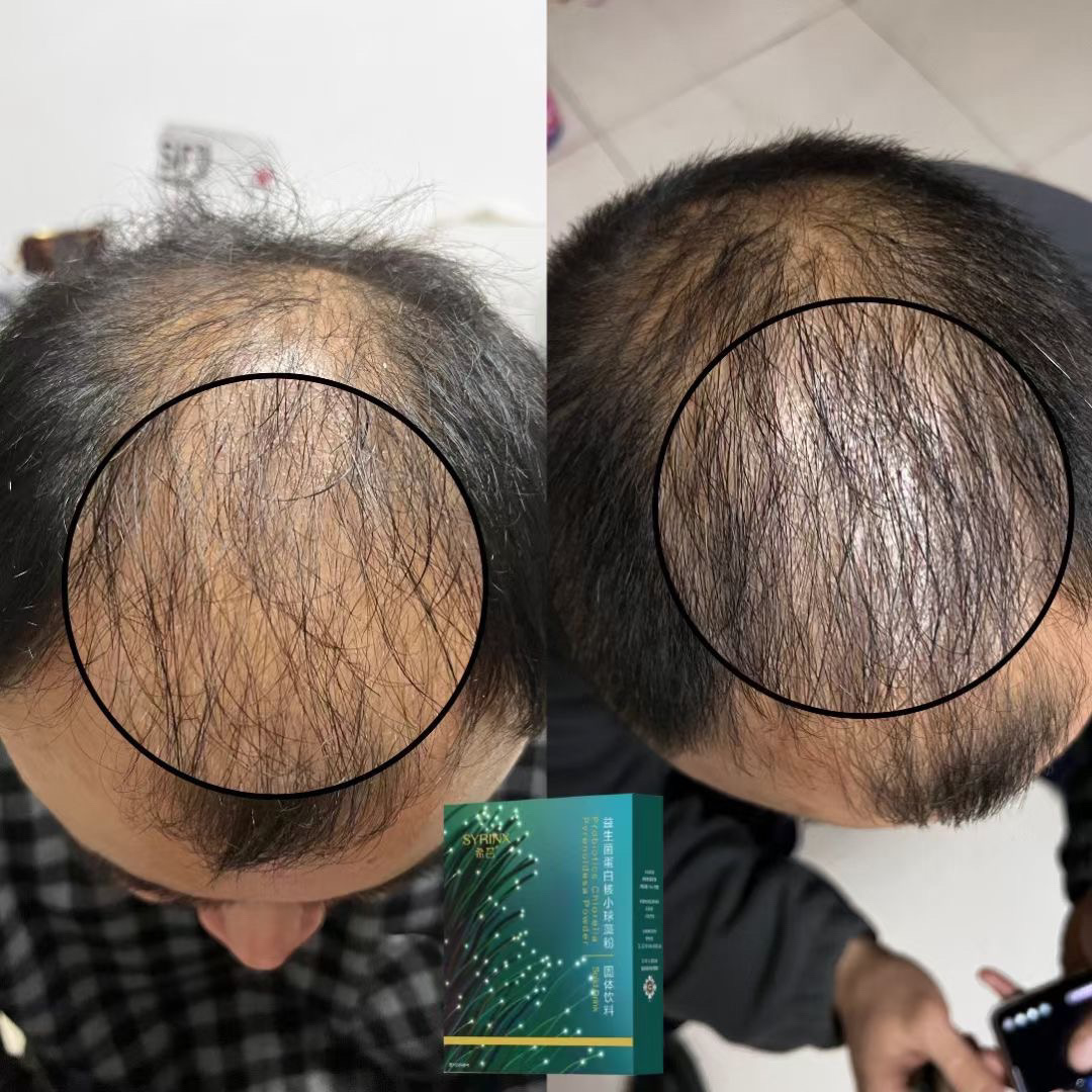 希芸防脱生发粉