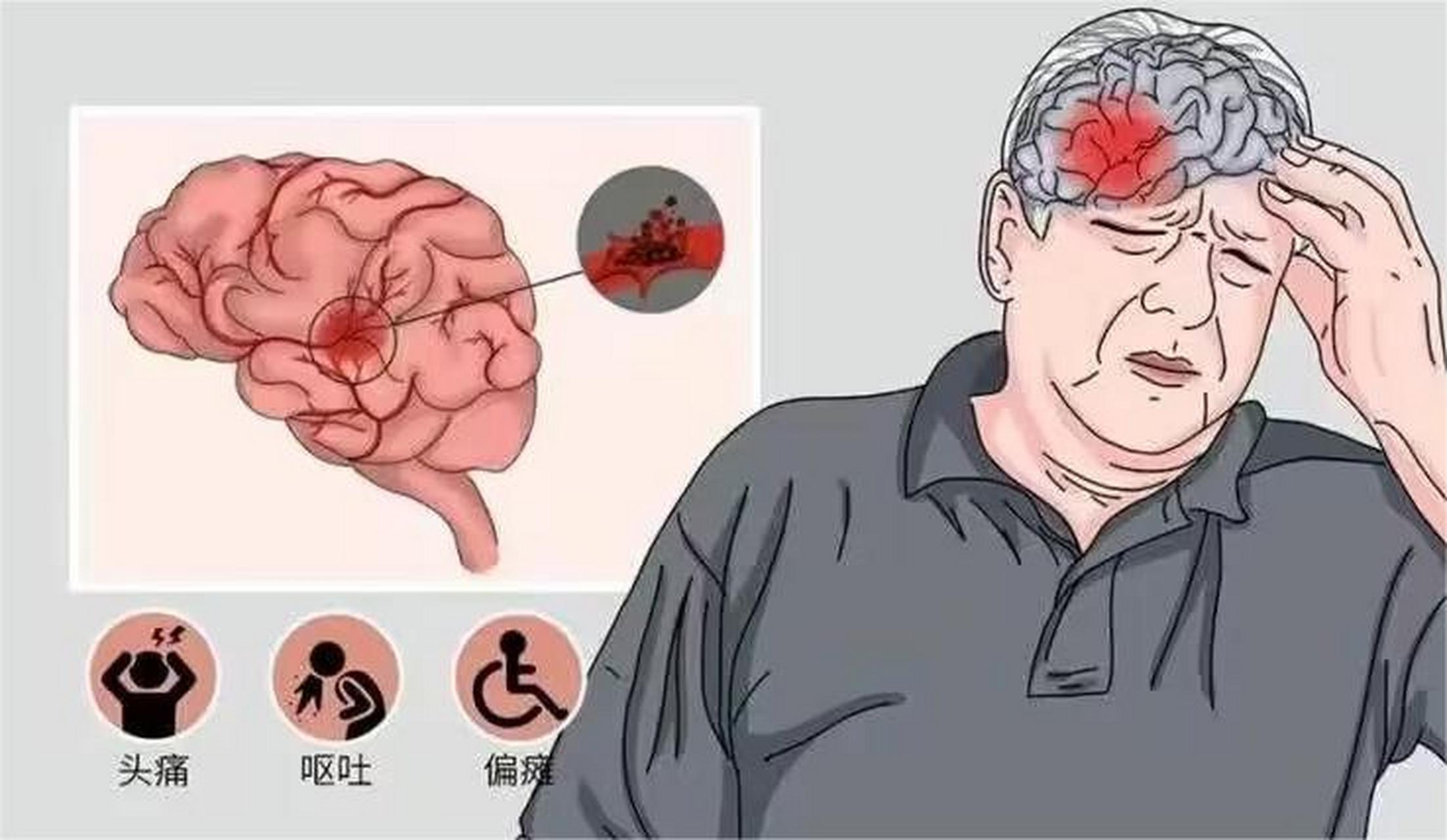 这个问题不能一概而论,因为根据供血的血管大小不同,梗塞造成的脑梗