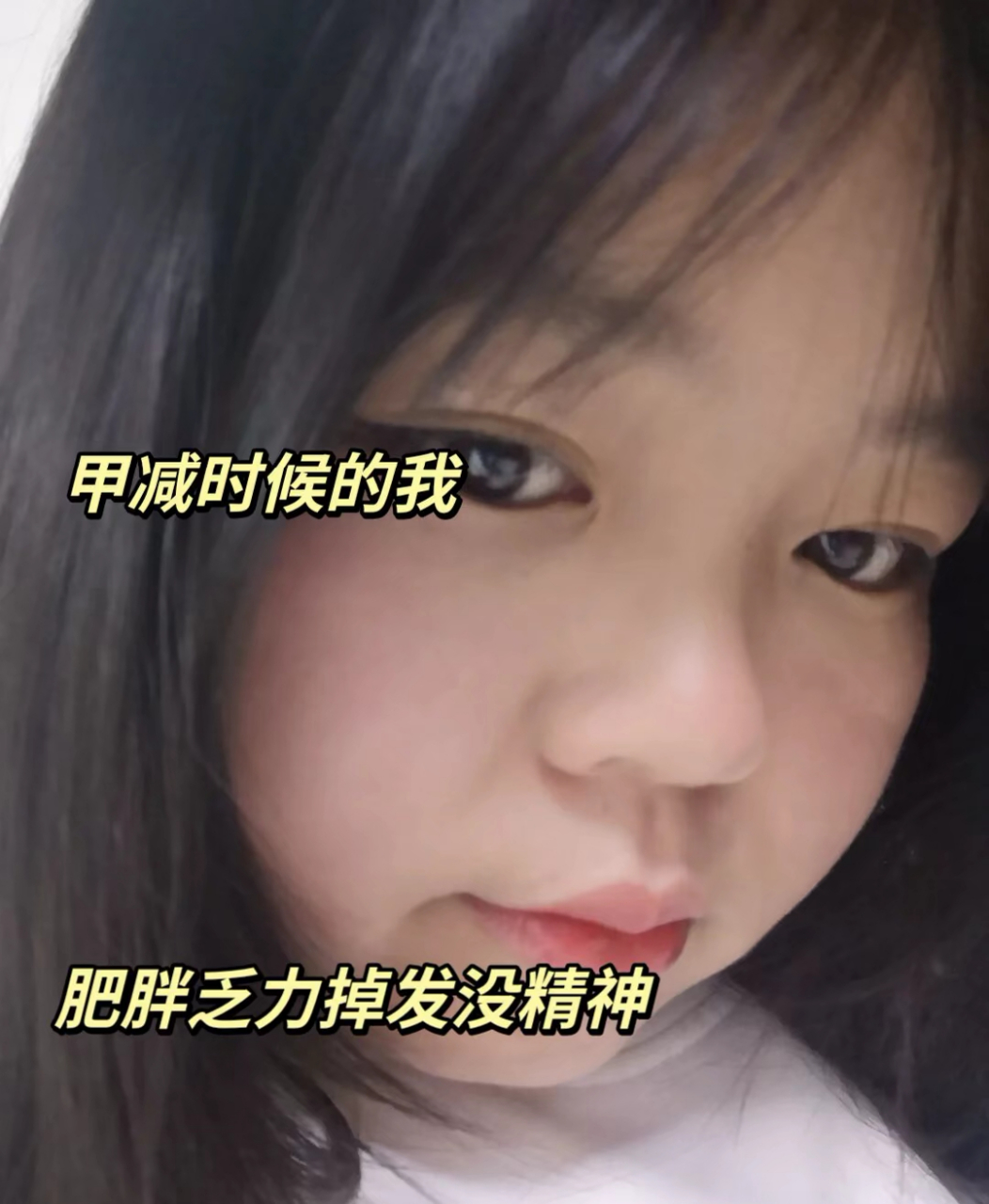 有需要的朋友自取一下哦#甲减# xst5879