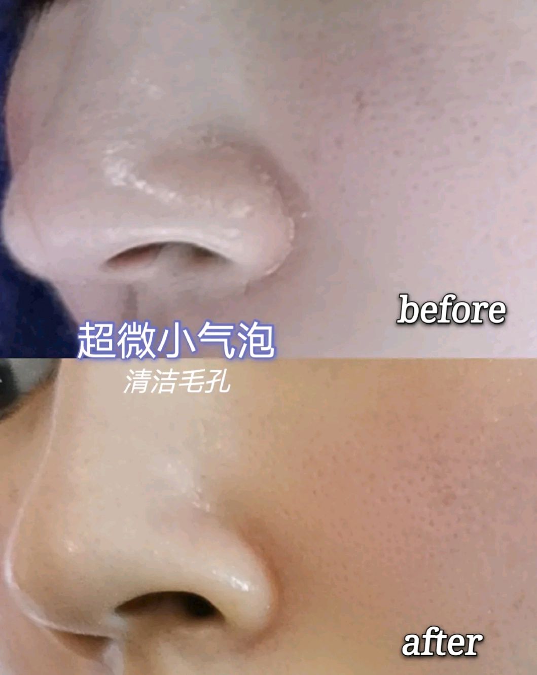 超微小气泡值得做么?