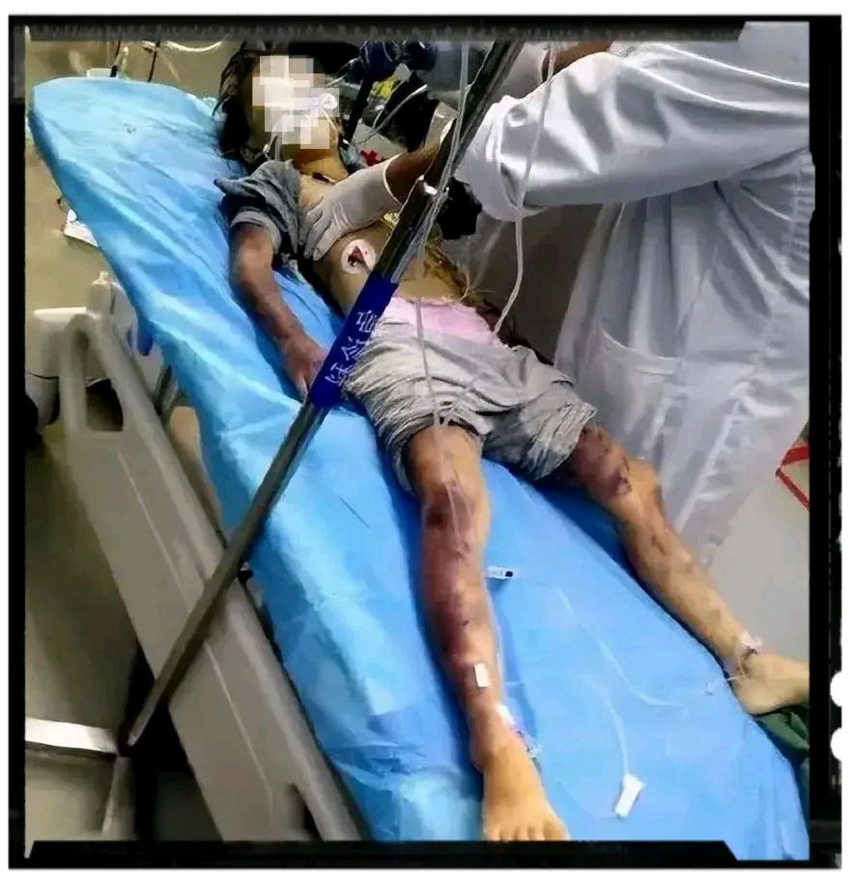 6岁女儿只因和父亲顶嘴,就被父亲狠心毒打身亡.