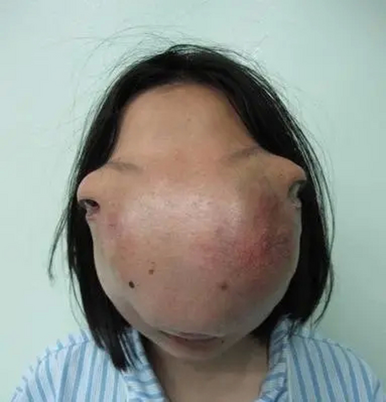 "一浙江女孩因疾病蒙面生活了13年,当她掀掉盖头后,饶是见多识广的