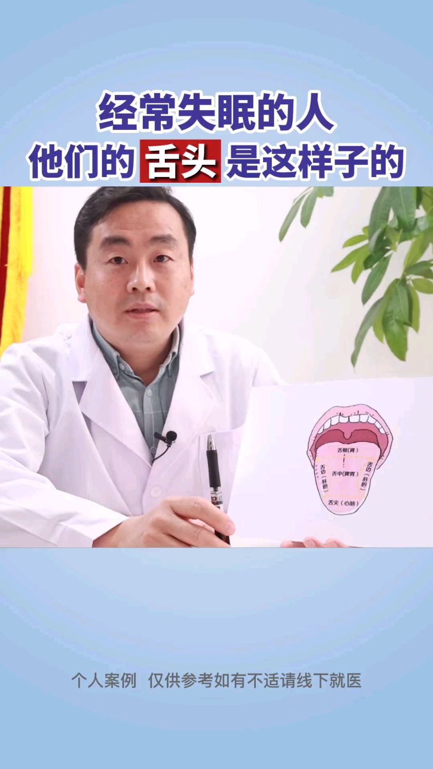 经常失眠的人他的舌头是这个样子的