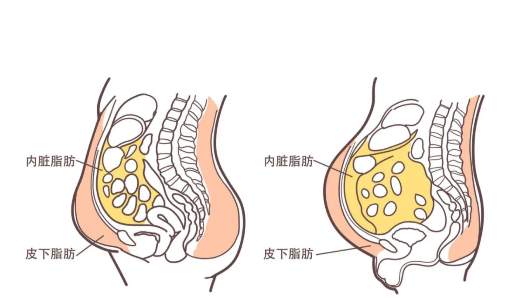 人体脂肪分解图片