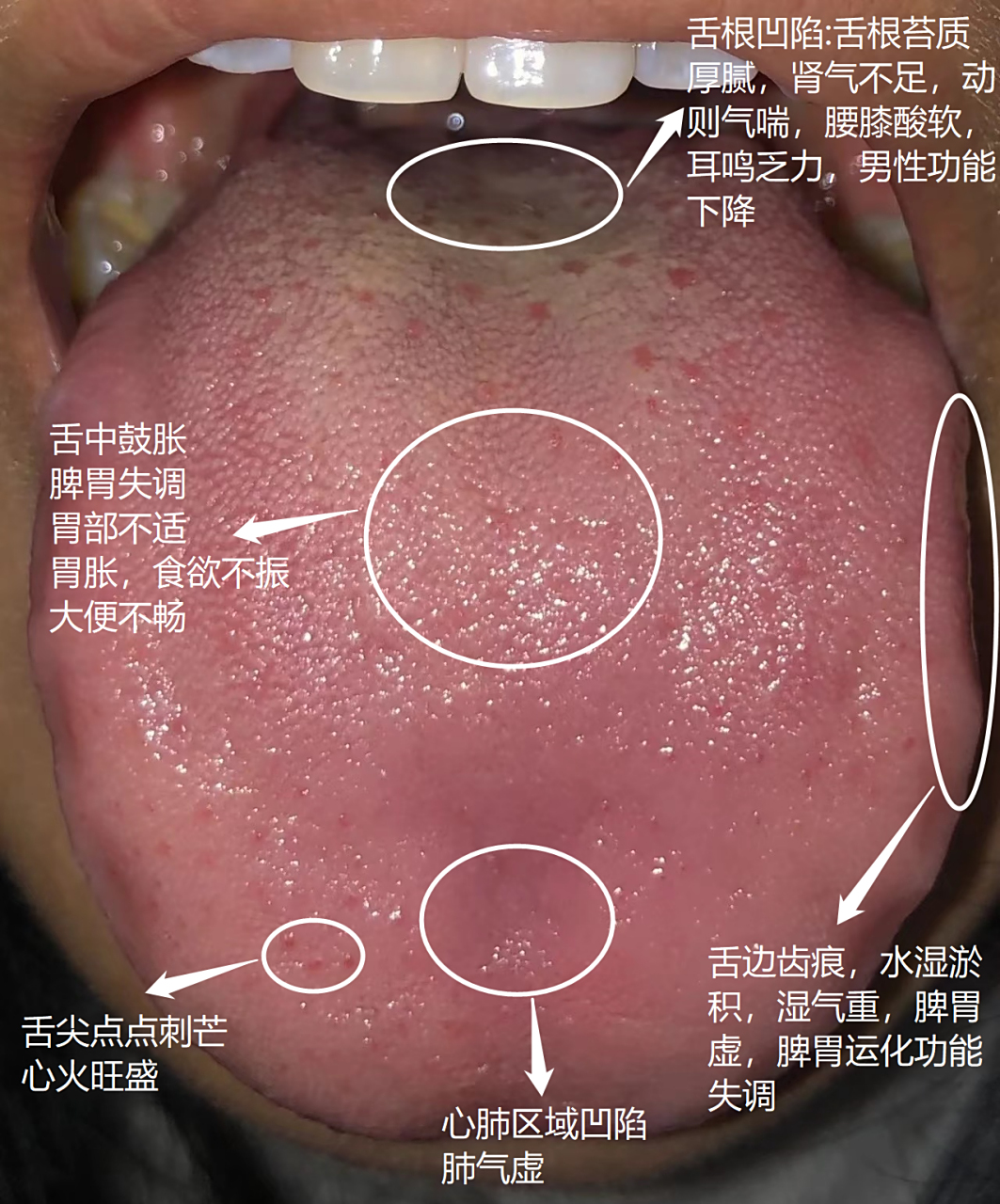 粉丝问诊舌像#肾虚# #中医# #养生