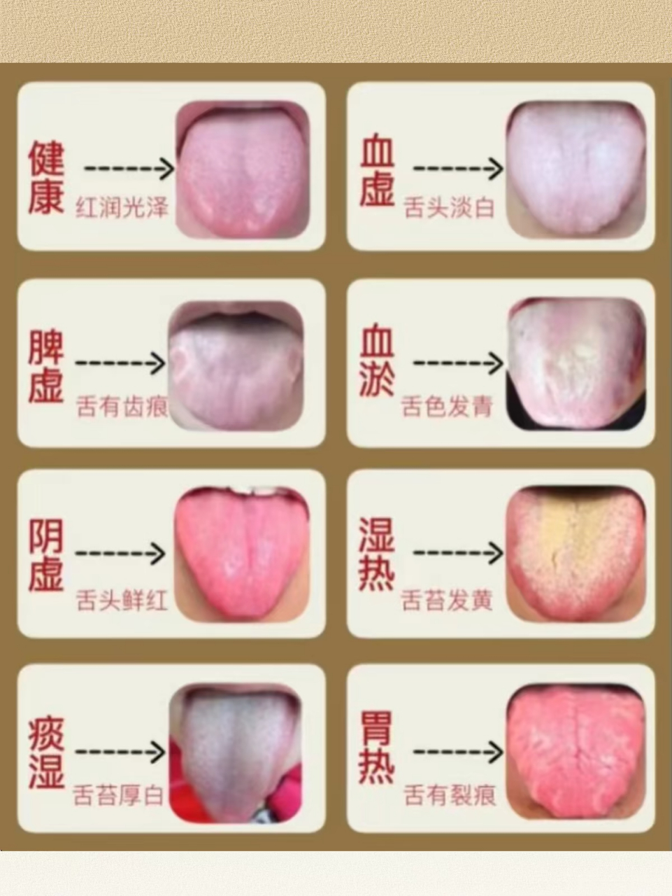 舌苔的几种表现图片图片