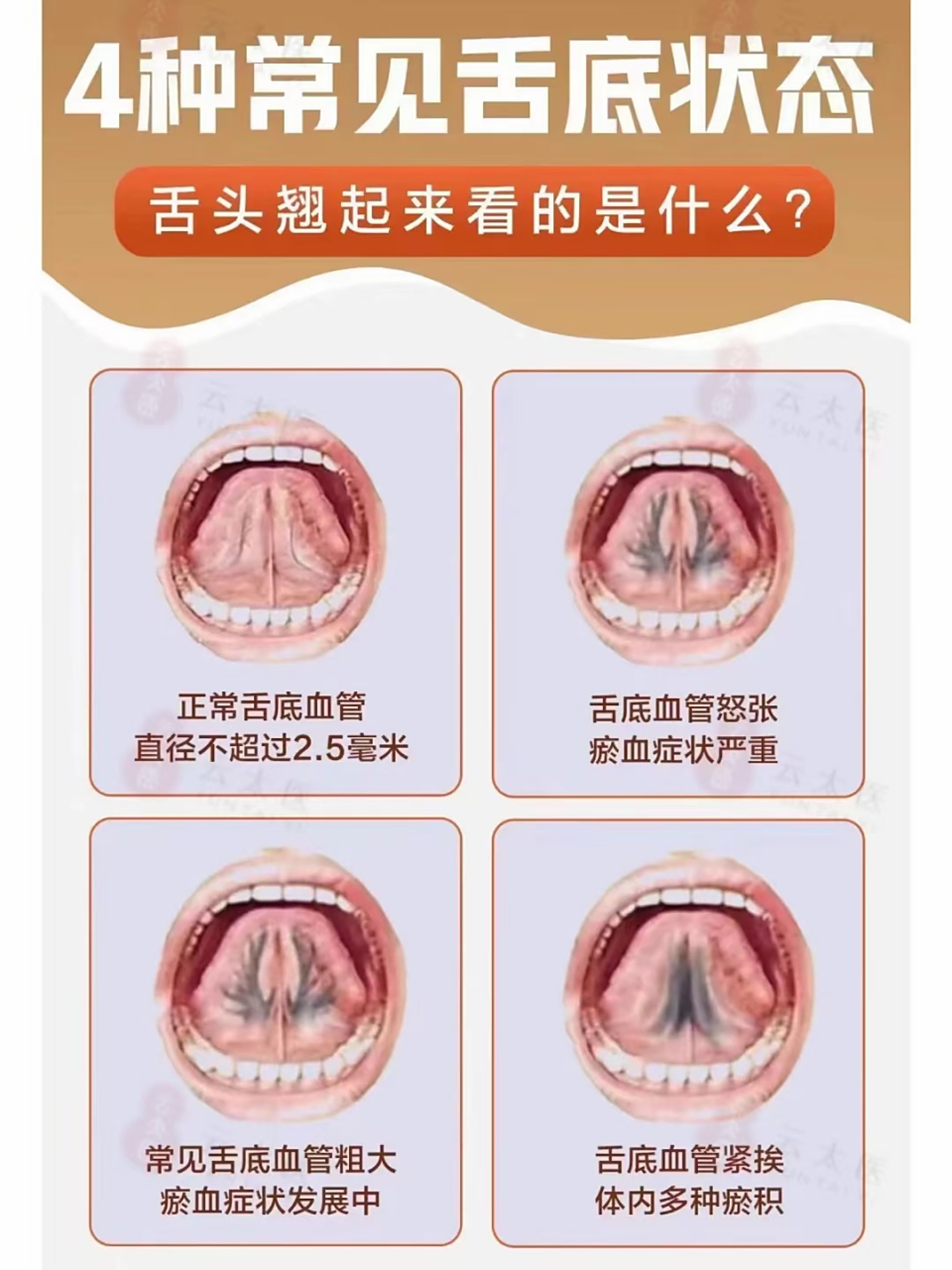 舌头可以反映身体健康状况,大夫通过患者舌苔,舌下经络,都能看出很多