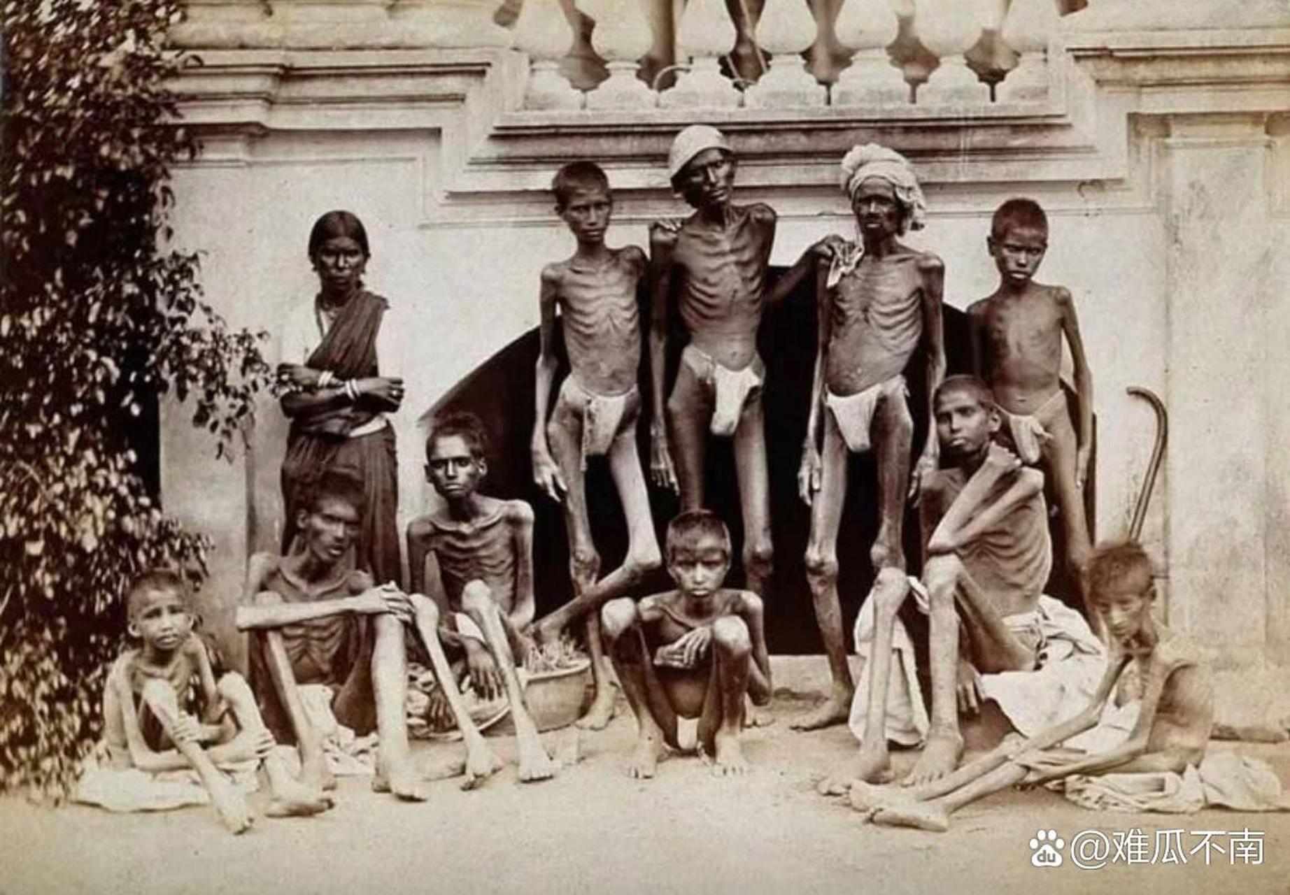 印度饥饿儿童图片