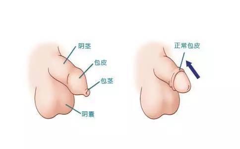 丁丁图清晰图片