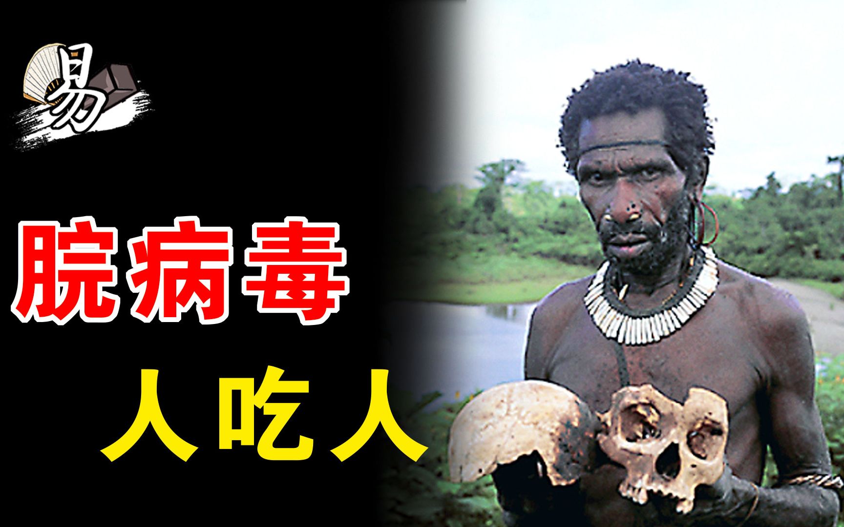 现实生活中爆发丧尸病毒可能性有多大?其实早就有丧尸病毒朊病毒