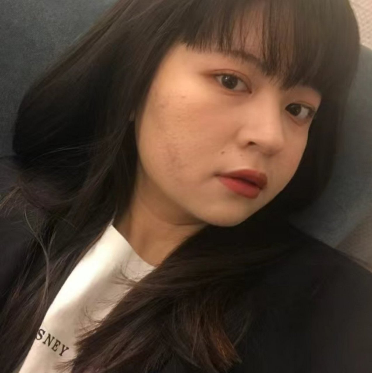 甲减面容对比! 甲减好了又回到美丽的状态!