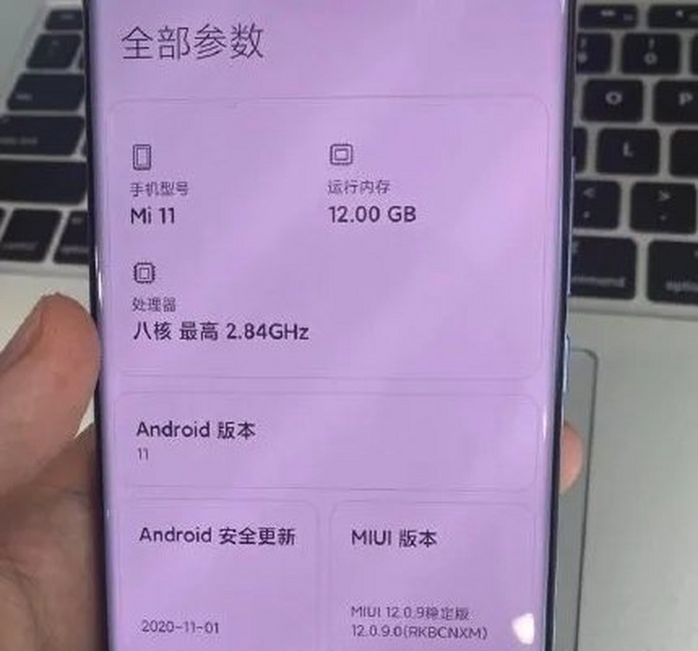 小米11素皮版现身,大家觉得怎么样,高级感有没有[太开心]  此次的小米