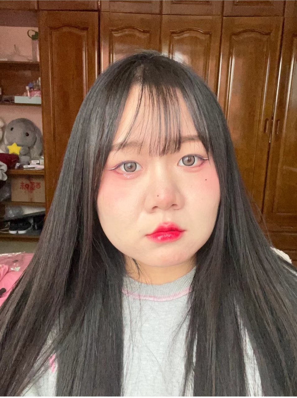 甲减患者对比照,体重从高峰到平稳#甲减