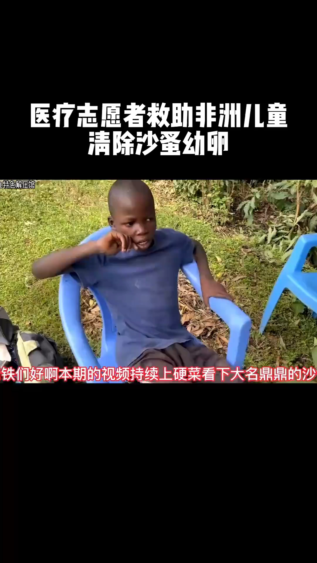 医疗自愿者救助非洲儿童,帮助清理沙蚤幼卵,前方高能,请勿请勿观看.