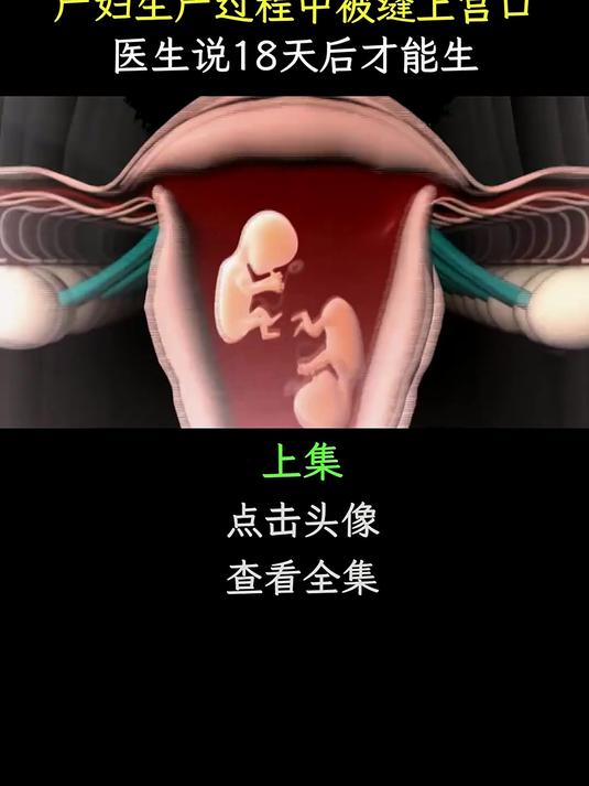 产妇分娩遭遇缝合宫口 医生称需18天恢复