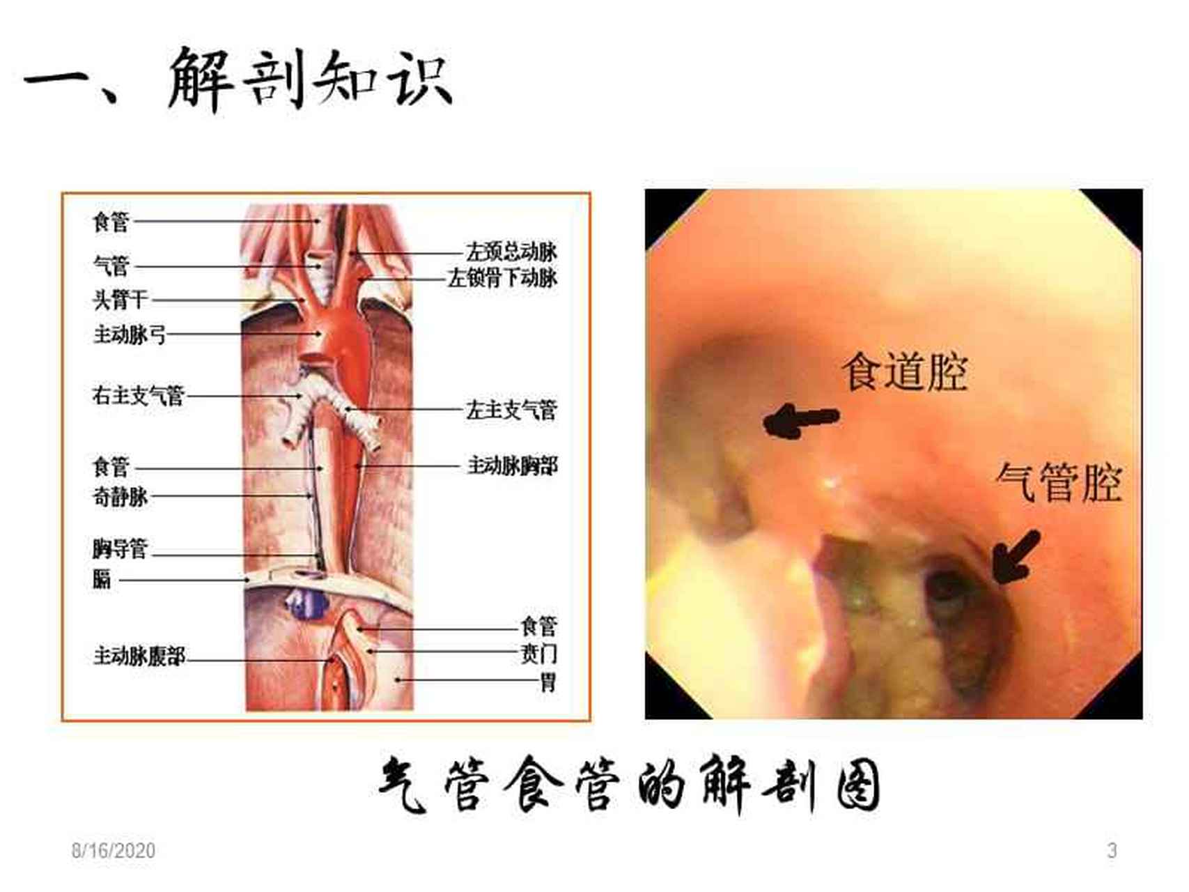 气管与胃管的结构图图片