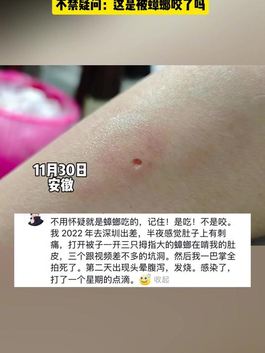 蟑螂会咬人?活了这么久才知道!来源:57395257589 蟑螂