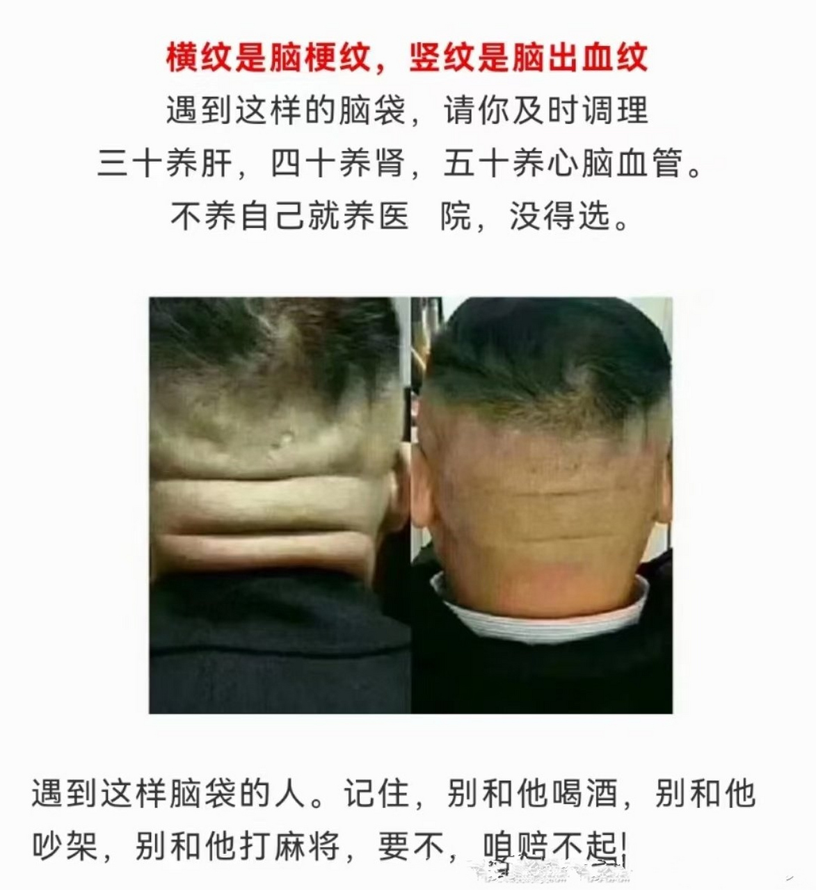 [烟花]横纹是脑梗纹,竖纹是脑出血纹,凸起是"炸药包",遇到这样的脑袋