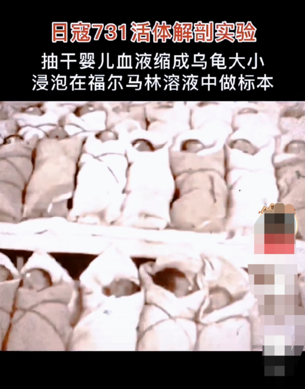 731部队婴儿实验图片