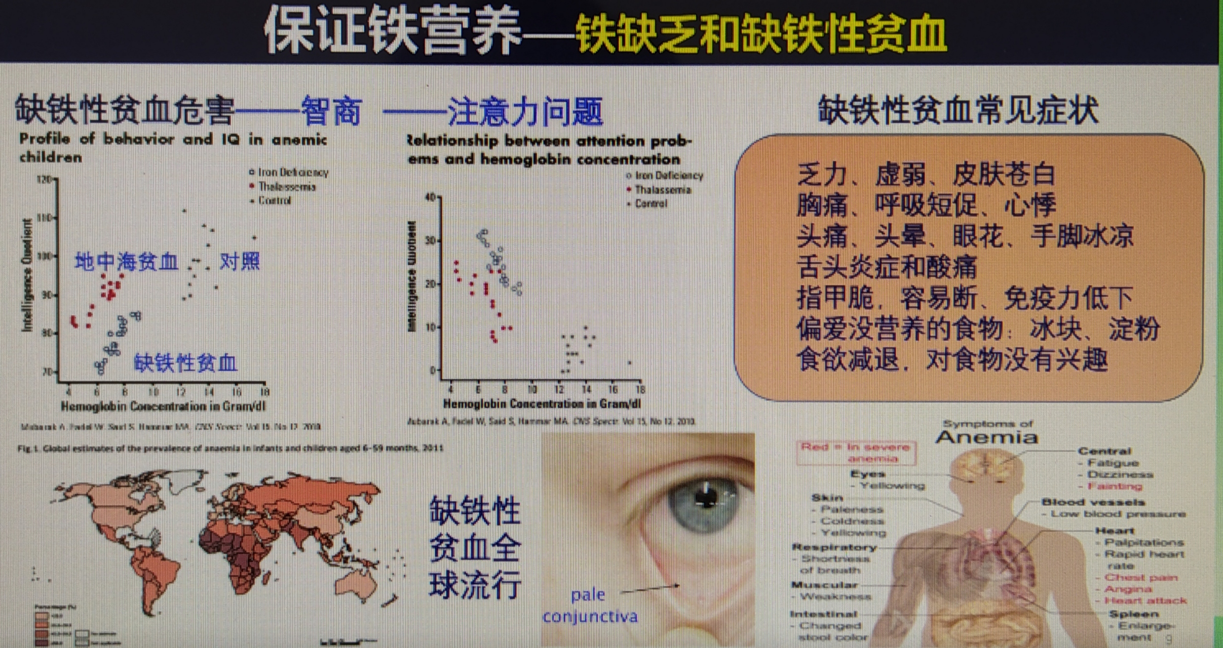 缺铁性贫血一一常见症状,膳食营养,预防措施