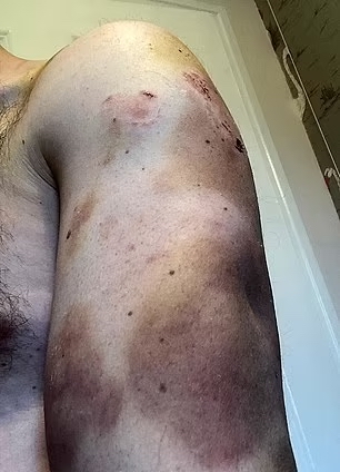 妻子殴打丈夫20年,男子用化妆的方式掩盖自己的淤伤