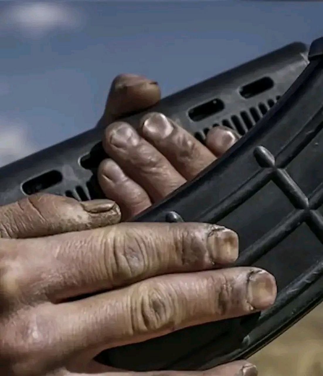 这是一名95后高原边防战士的手,由于长期缺氧,指甲已经严重凹陷变形