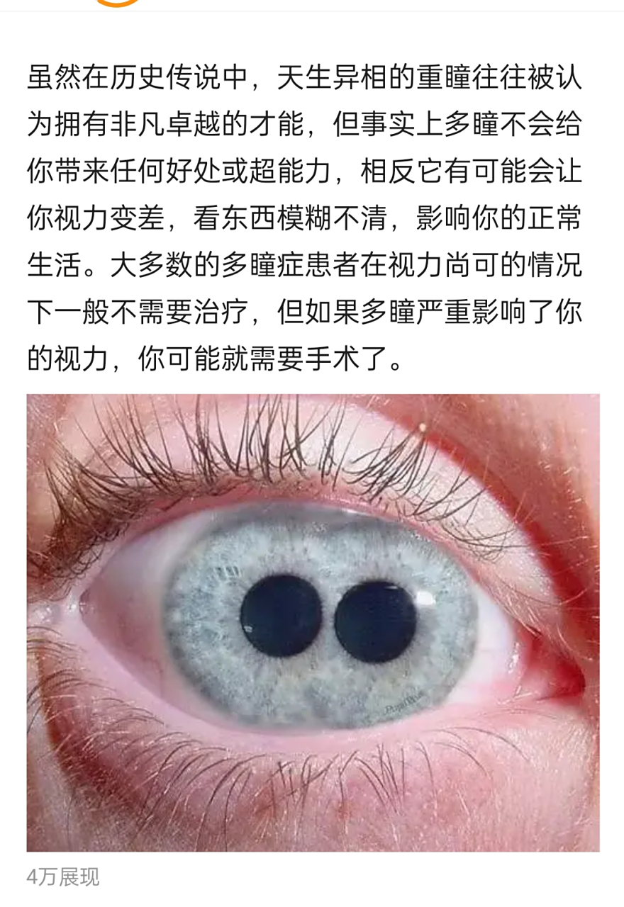 项羽icon本纪记载 , 占位太史公icon曰:吾闻之周生曰:"舜目盖重瞳子