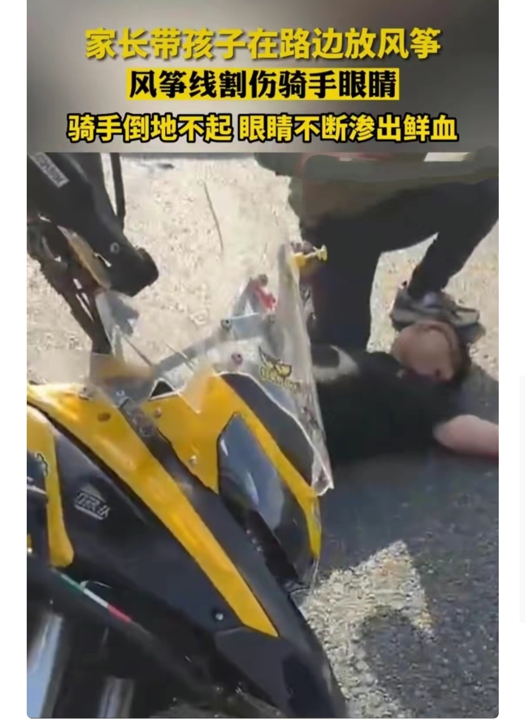 又一风筝线割人事件!安徽一骑手被线割眼,双眼流血不止恐失明!