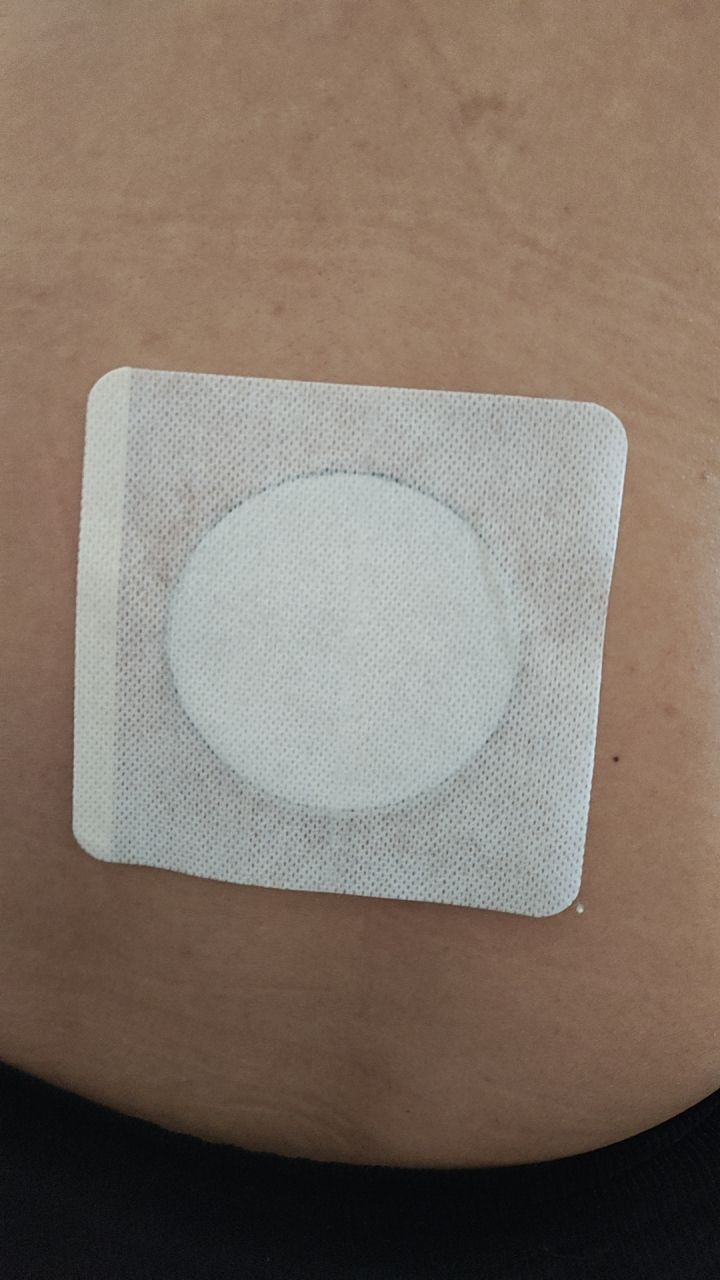 膏药贴敷示意图