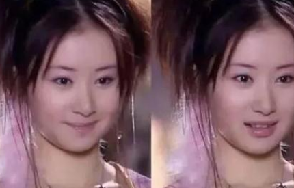 有种"整容"叫18年后的舒畅,曾经的小狐狸,如今已判若两人