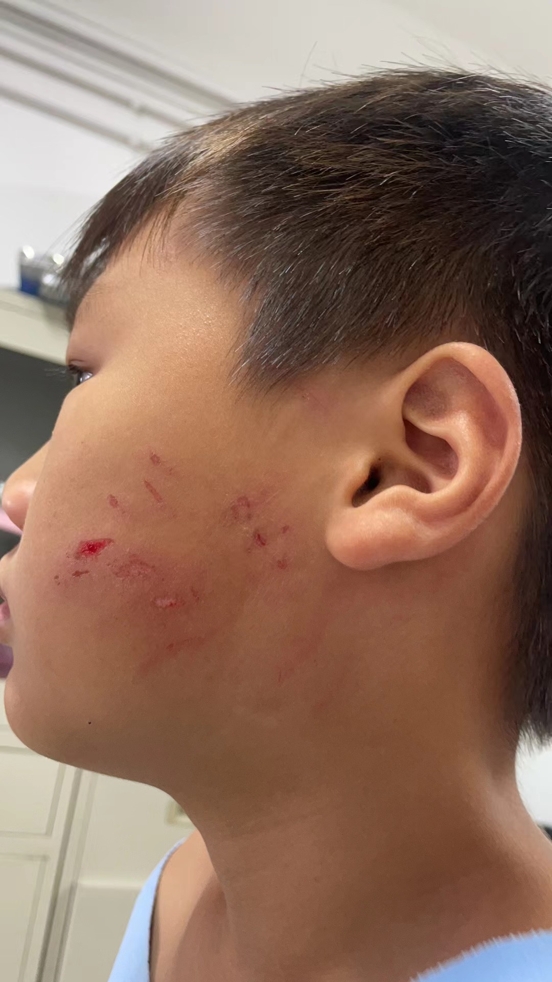 这孩子是有多心善,多懂事呢,脸被抠成这样,还在跟