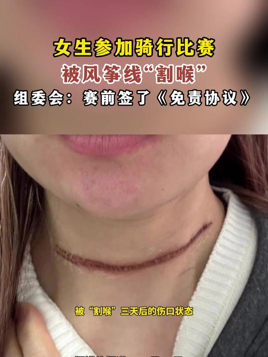 女人被割喉图片