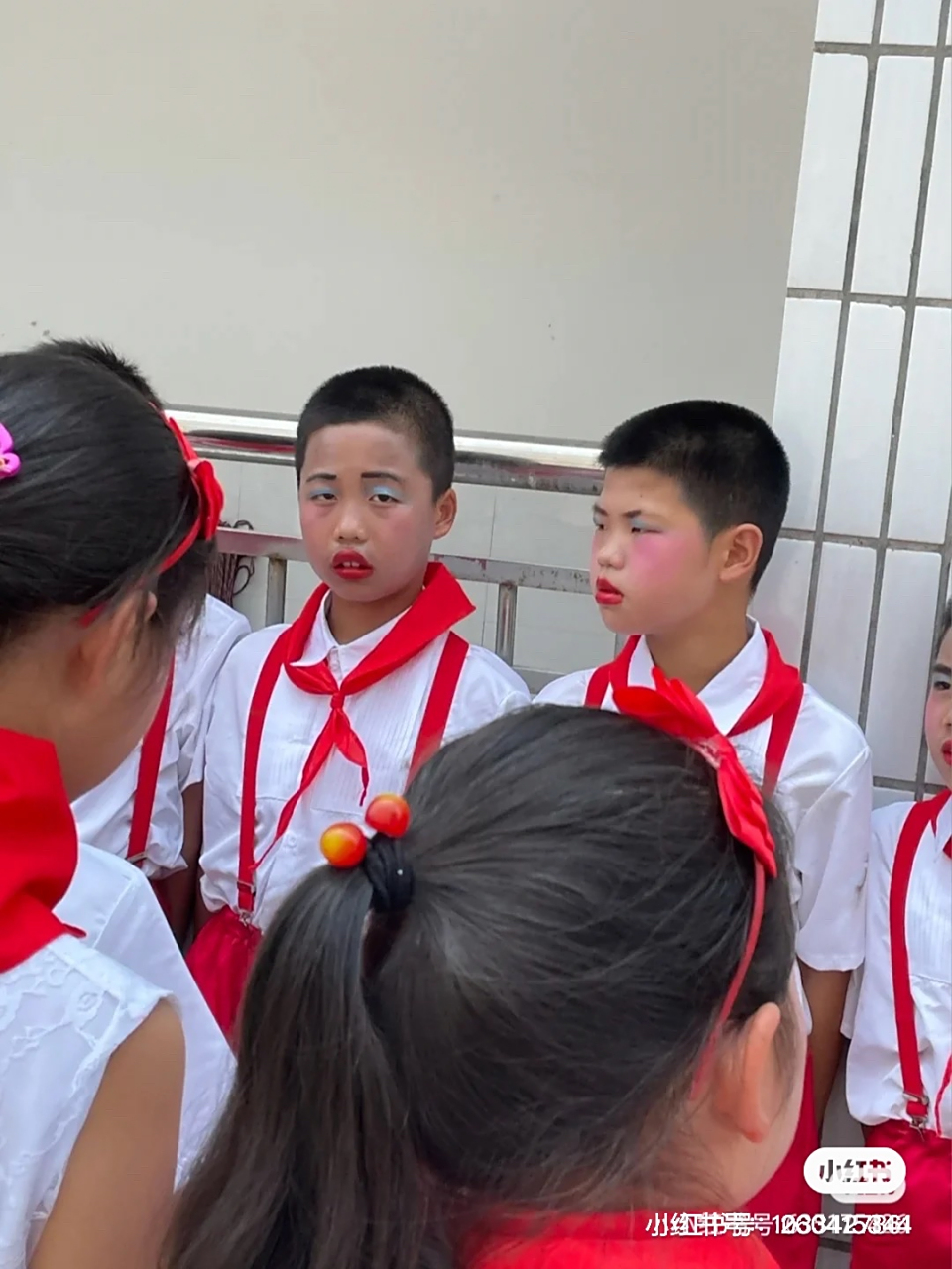 美中不足的是额头上的小红点呢?