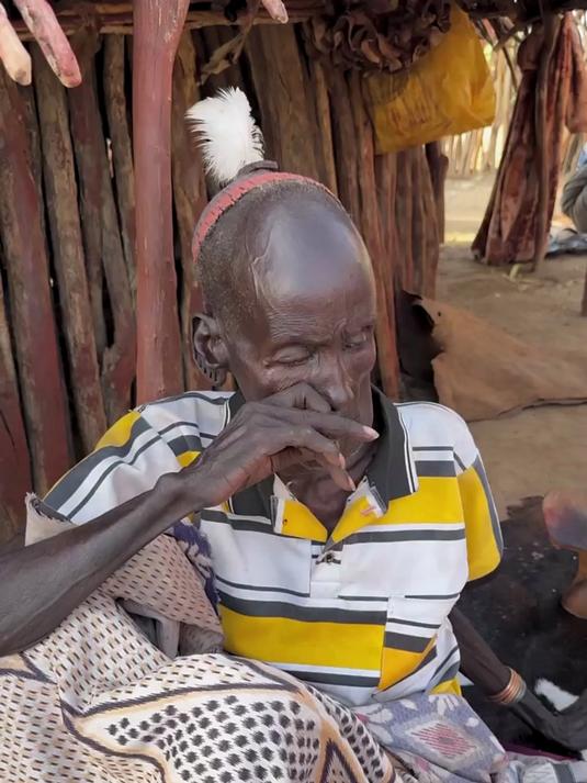 非洲酋长生病了!