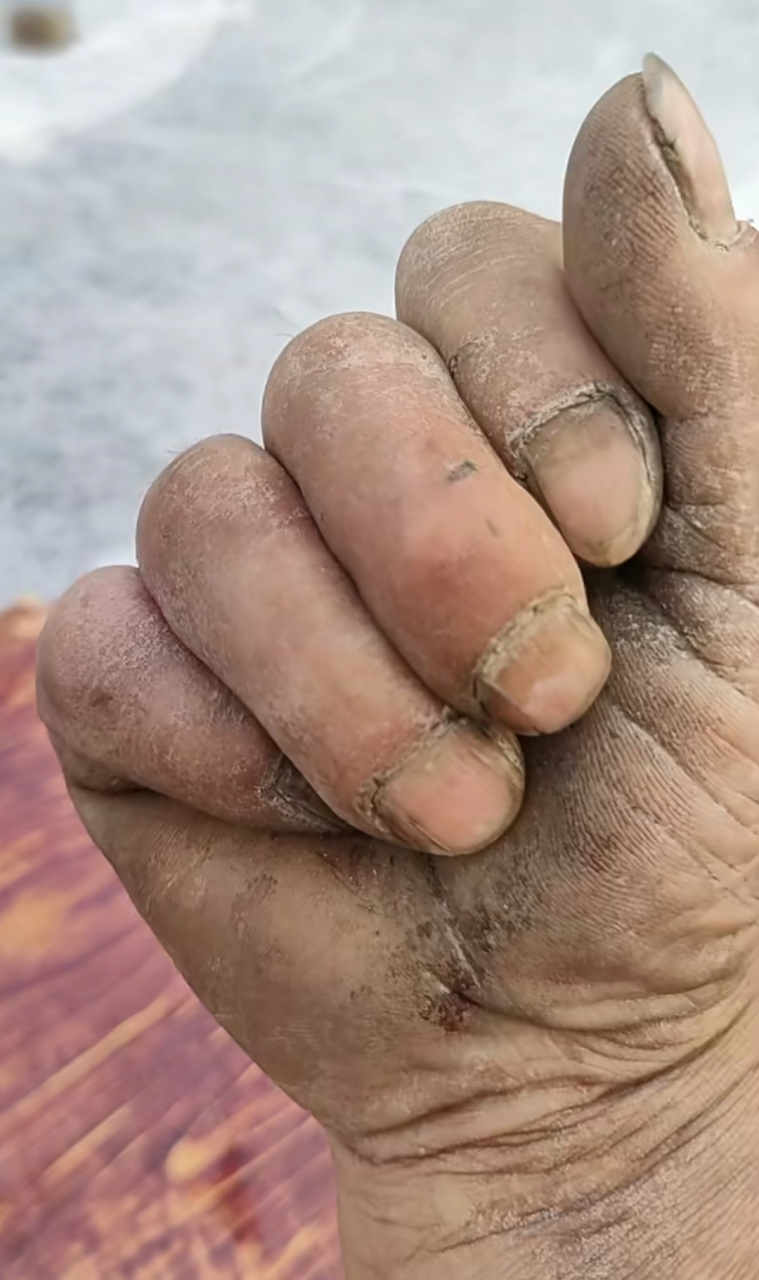 这就是劳动人民的手啊,发一张你们上班后的手成什么样了?