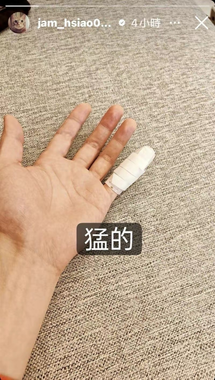 近日,萧敬腾在与好友打篮球时意外受伤,导致右手小拇指骨折,他在社交