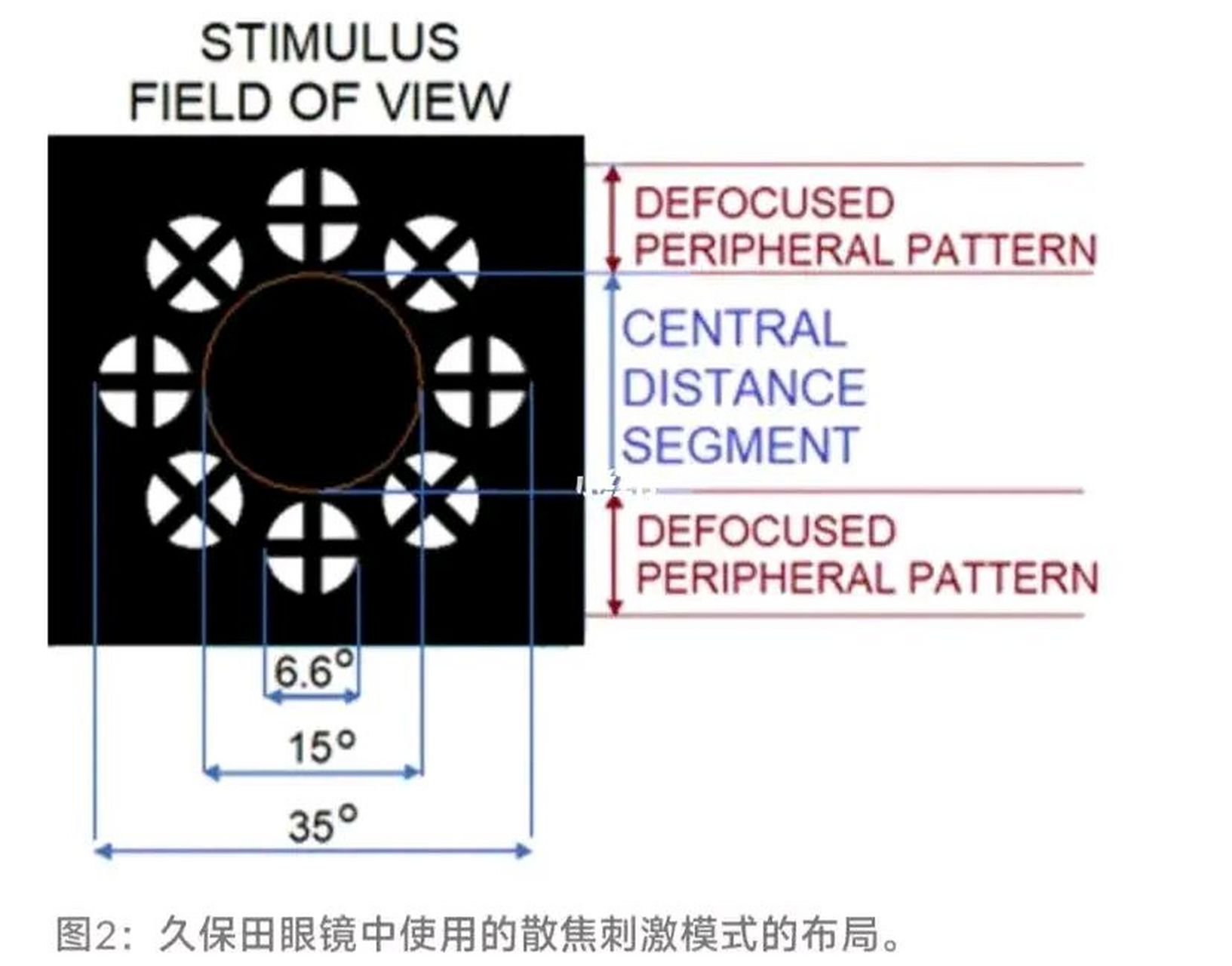 根据日本媒体报道,日本洼田制药研发的这种叫做"洼田眼镜"镜头的中哪