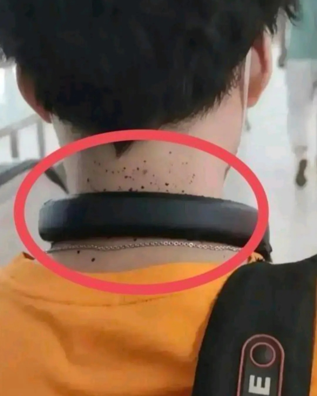 小哥哥的脖子要去挂什么科呢?