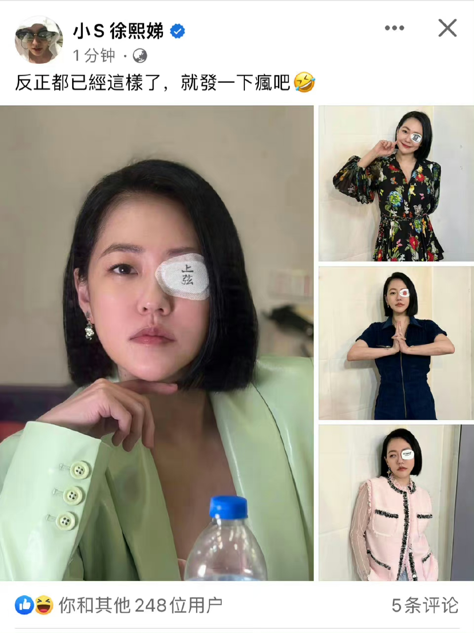 小s是被家暴了吗
