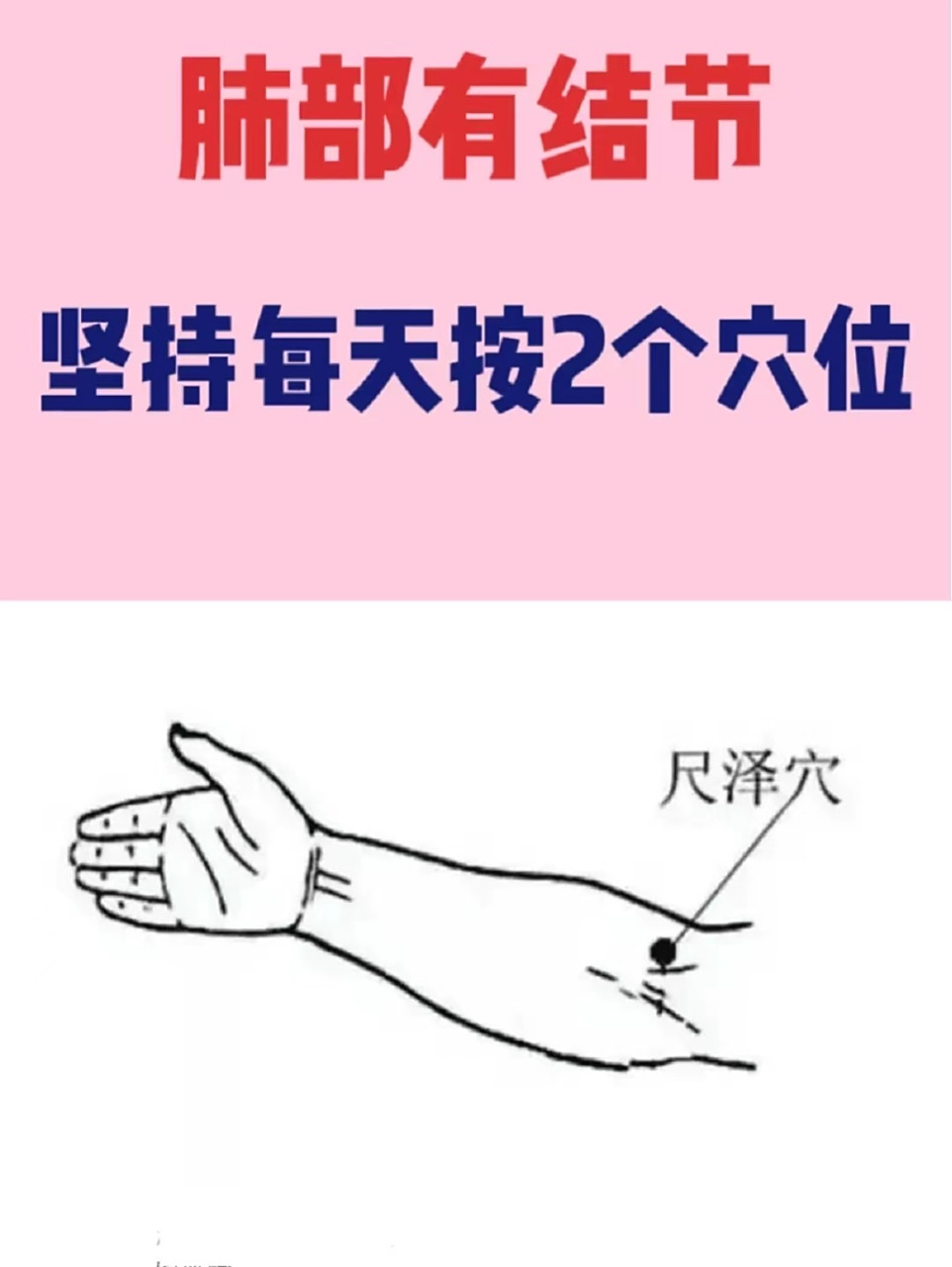 坚持每天按揉2个穴位,对消肺结节有帮助1,尺泽穴 位置:手臂内侧中央处