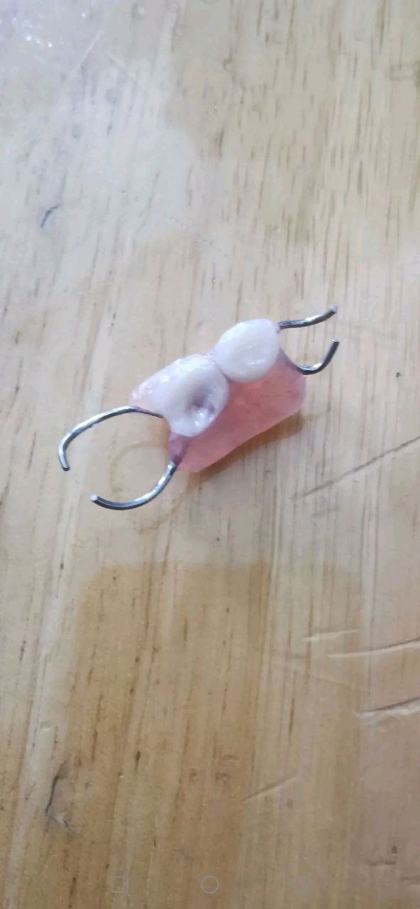 做了个假牙后悔死了!